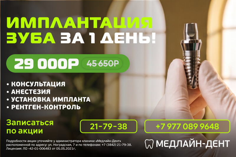 Имплантация зуба за 1 день по выгодной цене